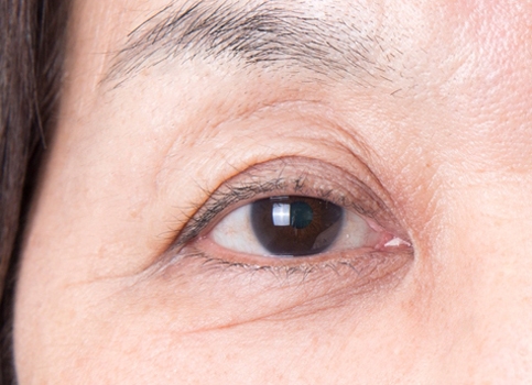 装着前 Cカール