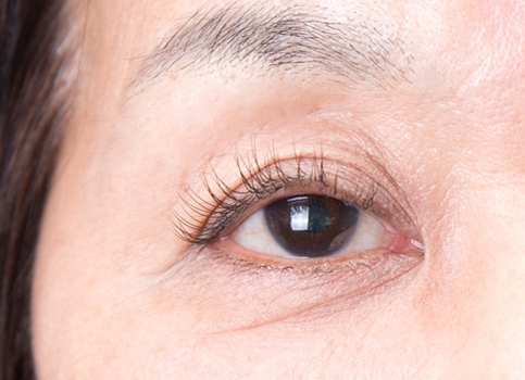 装着後 Cカール