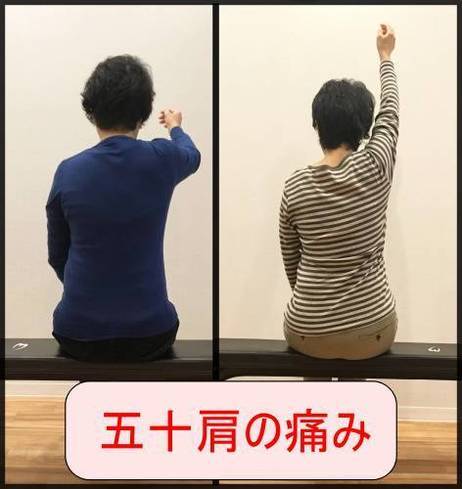 五十肩 変化HP_コピー