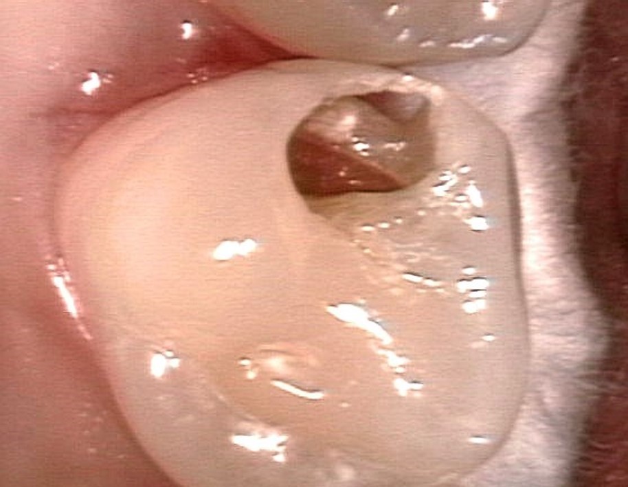 CR1
