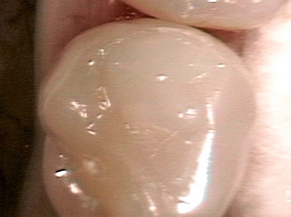 CR2