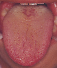 無痛治療・口臭治療