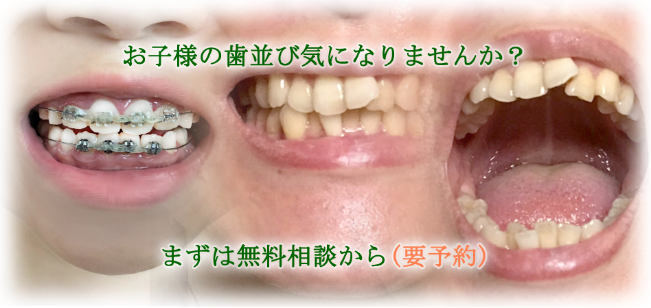 お子様の歯並び気になりませんか?