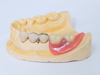 ブリッジの感覚