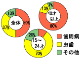 歯周病|山田歯科クリニック