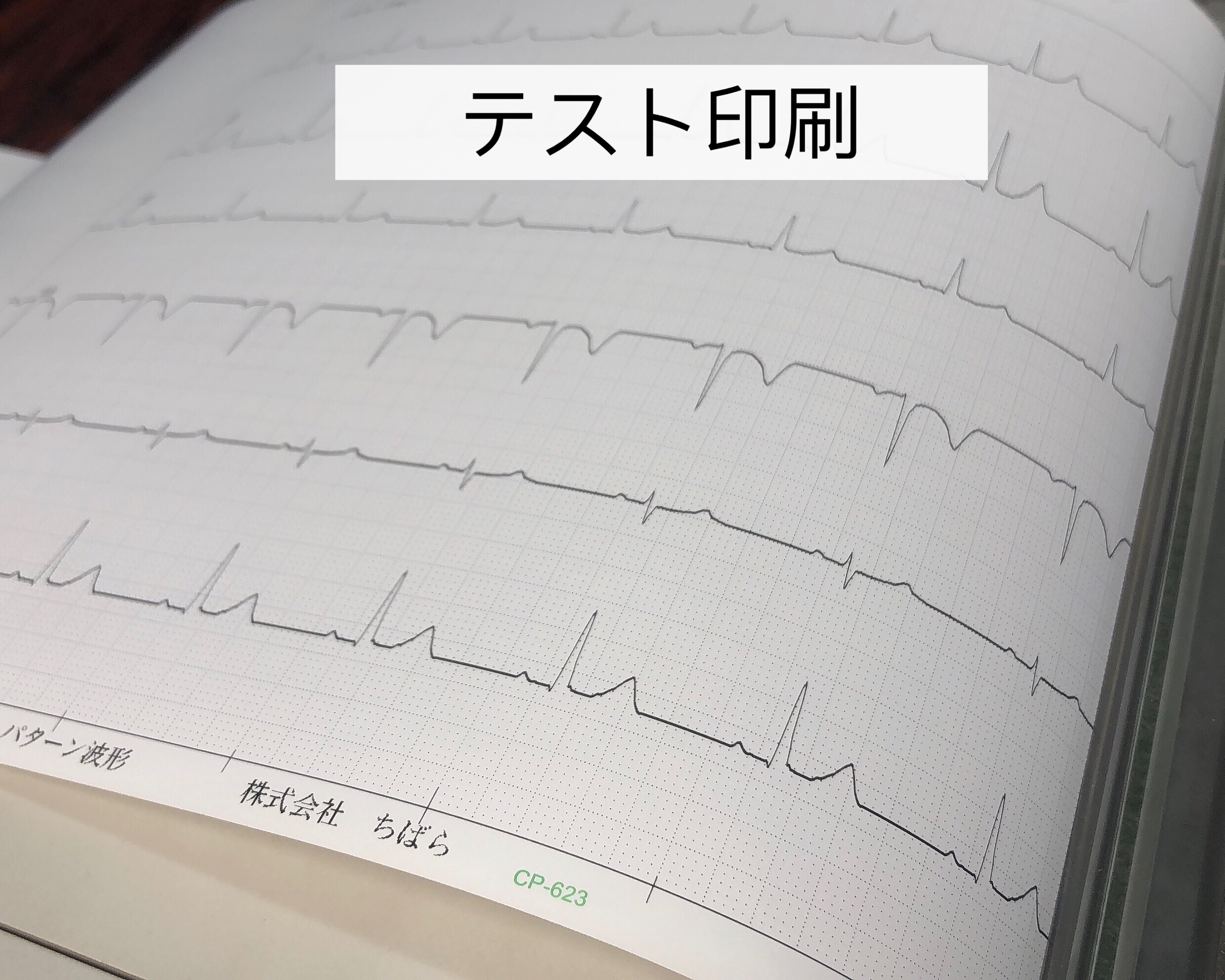 ホルター心電図用記録紙 CP-623 テスト印刷