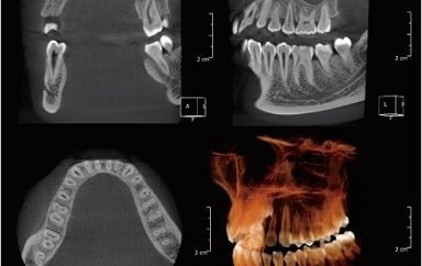 156033932662001_resize(225)