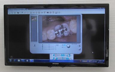 155437632293401_resize(225)