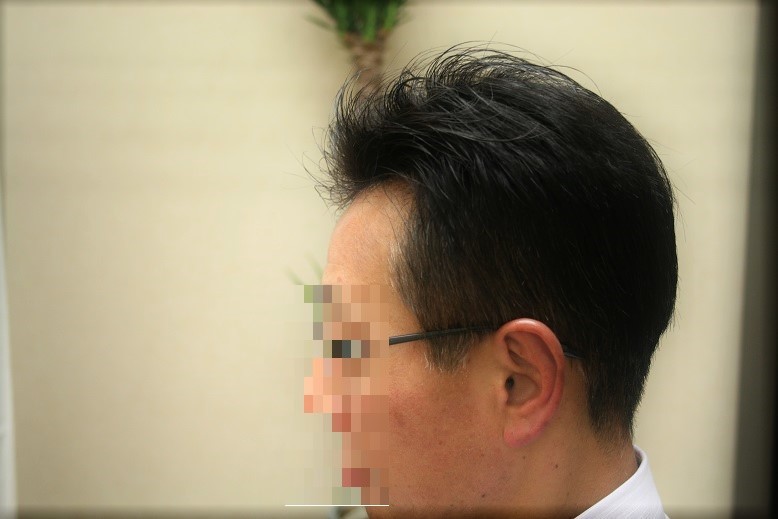 フロントは極薄ネット(0.06ミリ)使用