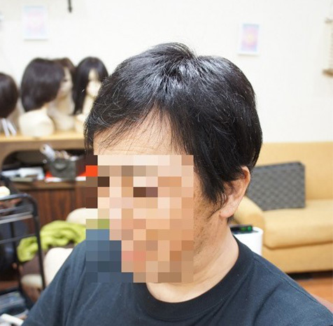 リアルな人工頭皮が入ったタイプ