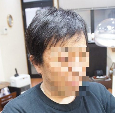 リアルな人工頭皮が入ったタイプ