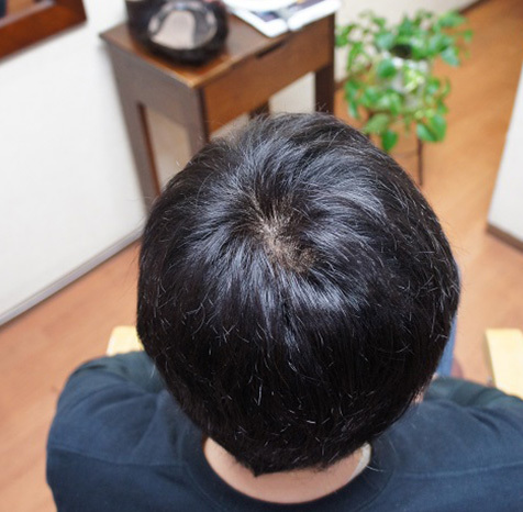 リアルな人工頭皮が入ったタイプ