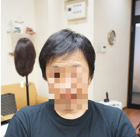 リアルな人工頭皮が入ったタイプ