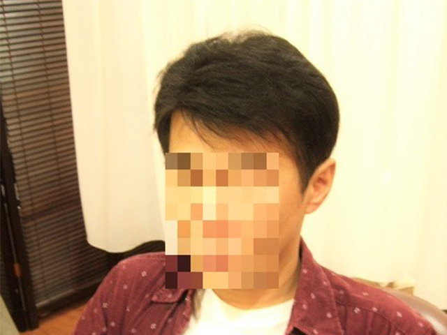 部分かつら(オーダーメイド)_After