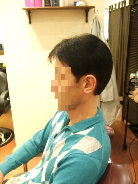 部分かつら(オーダーメイド)After