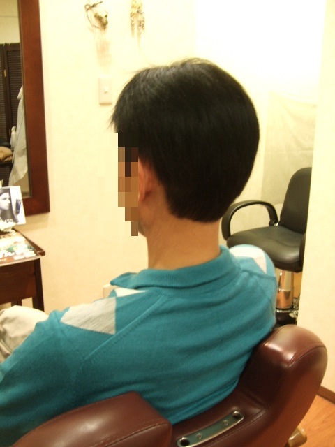部分かつら(オーダーメイド)After