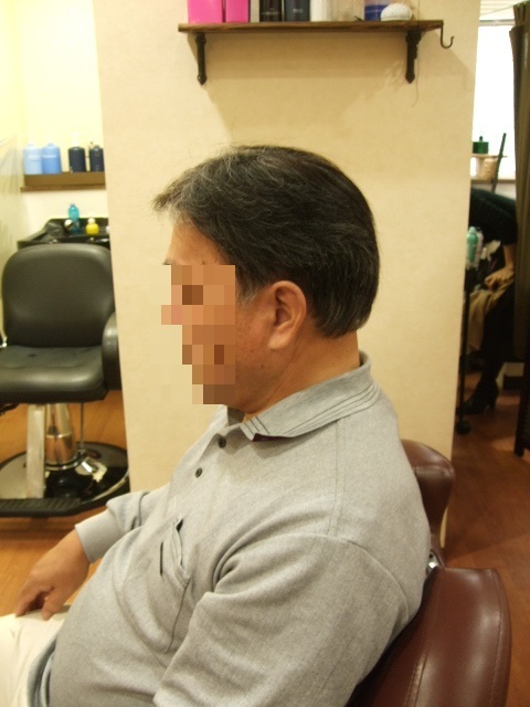 部分かつら(オーダーメイド)After