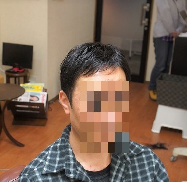 部分かつら(オーダーメイド)