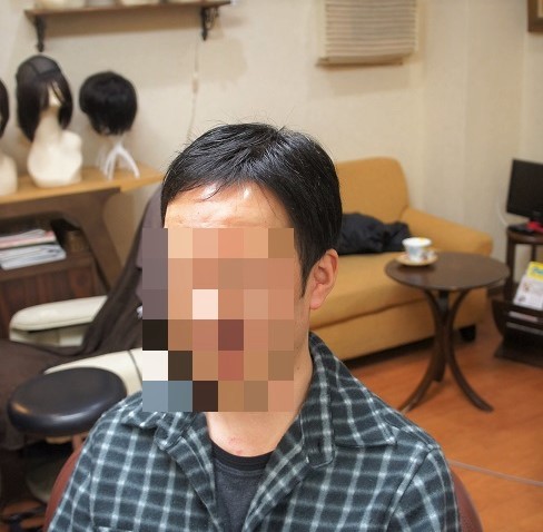 部分かつら(オーダーメイド)