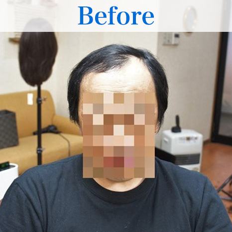 リアルな人工頭皮が入ったタイプ