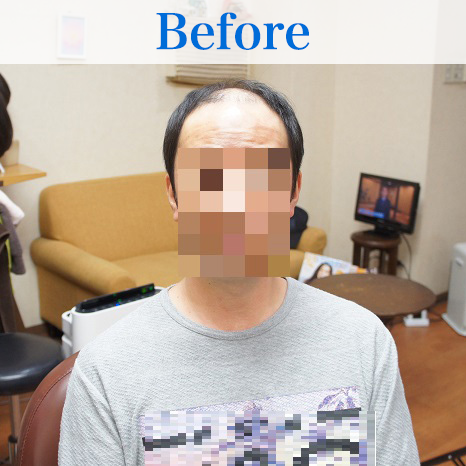 超薄型ネット1枚で作成