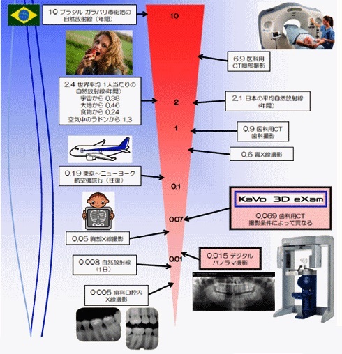 CT装置