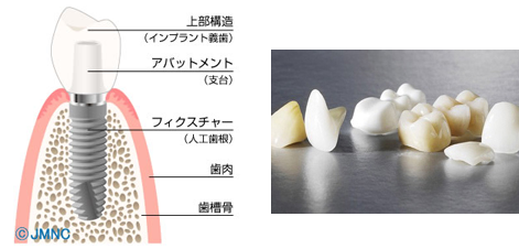 高度な治療技術と最先端の歯科医療|小早川歯科クリニック
