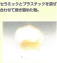 ハイブリットセラミックス|小早川歯科クリニック