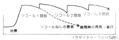 歯周病|小早川歯科クリニック