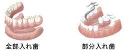 implant03