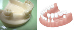 implant06