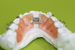シュワルツの拡大装置・小児矯正