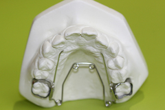 クオッドヘリクス・小児矯正