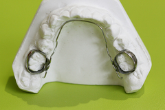 リンガルアーチ・小児矯正