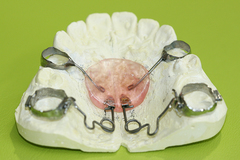 ペンデュラム・小児矯正