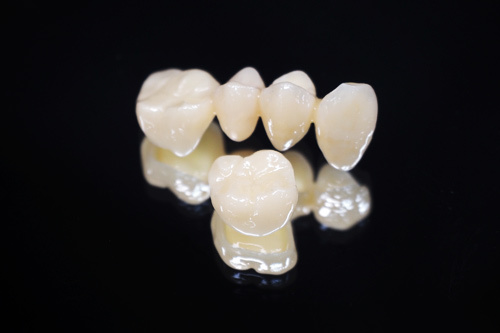 smilecrown01