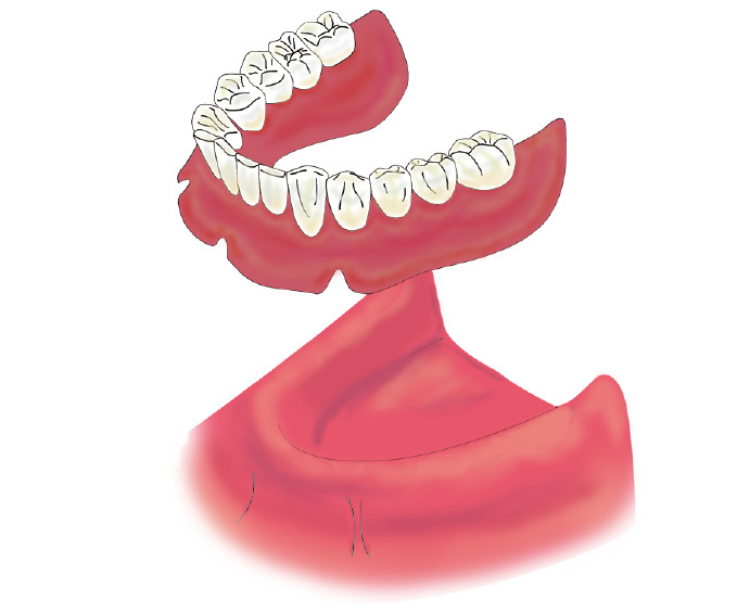 implant04