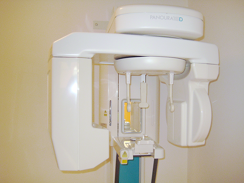 デジタルレントゲン