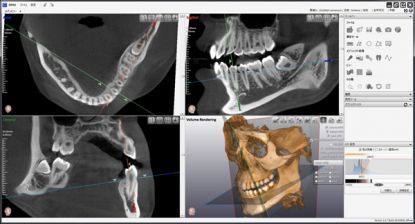 e4949f77fdc8967355a8d4bc33983105_f43