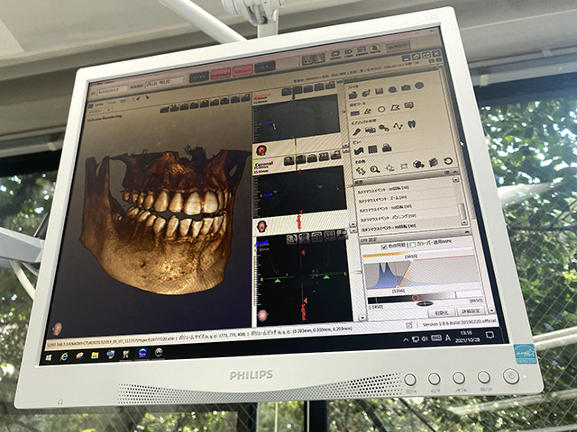 7_デジタルモニタ