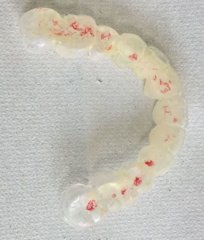 来院時の微調整