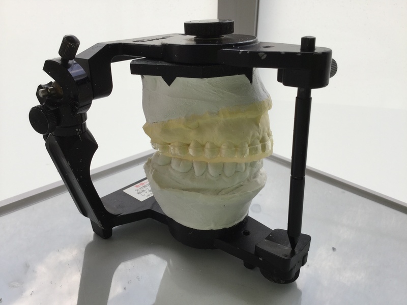 来院時までの調整