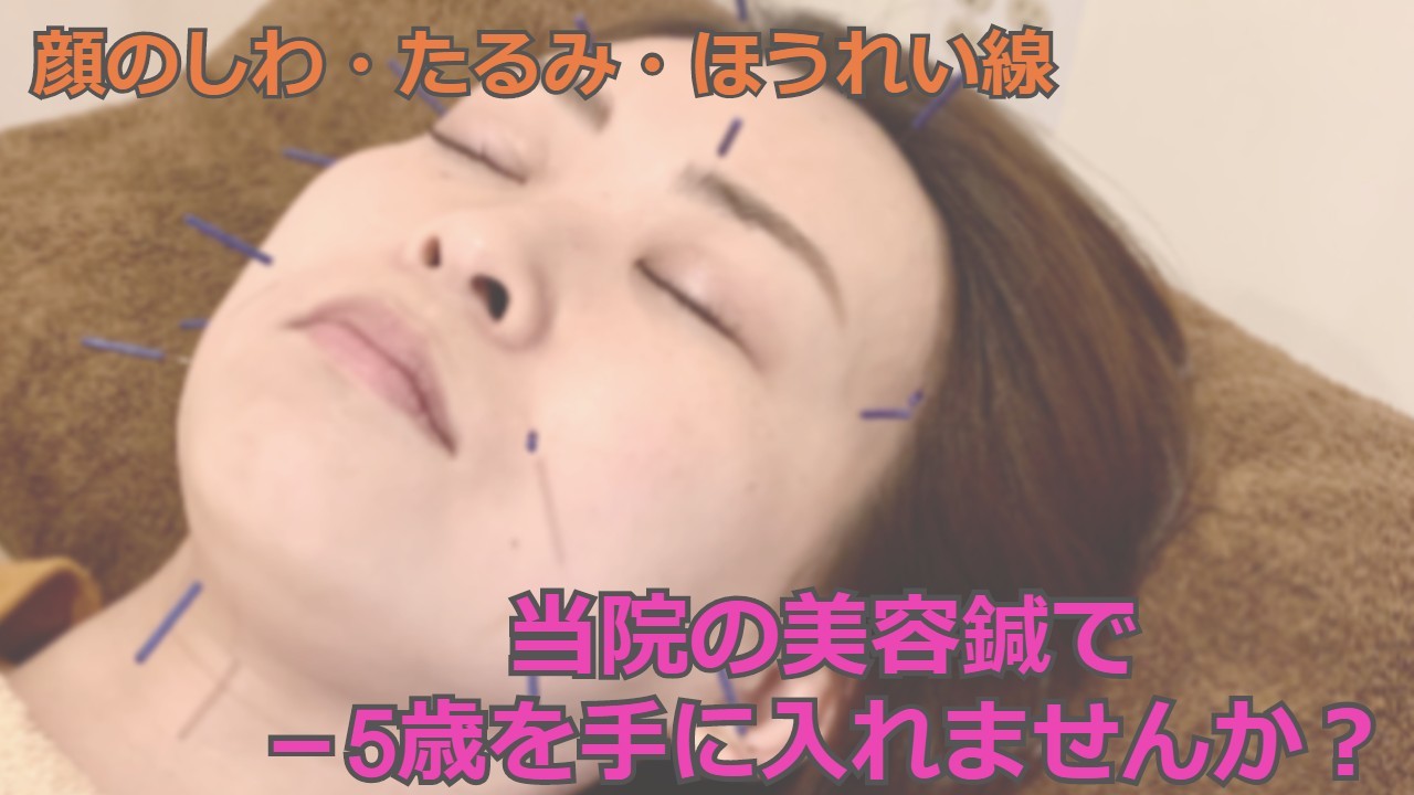 美容鍼