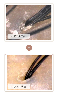弱酸性ヘア・エステ