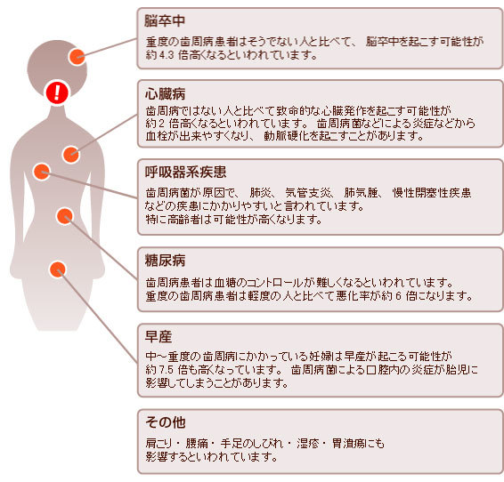 歯周病が原因