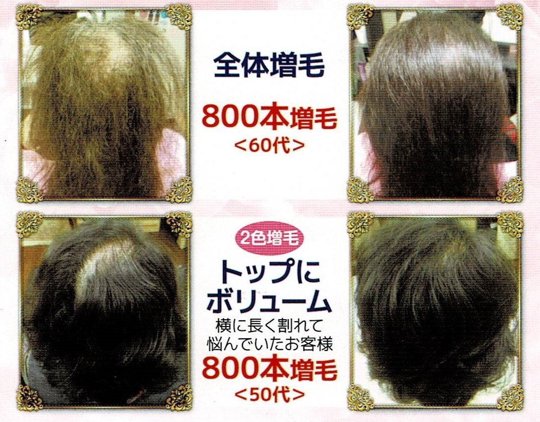 3Dビフォーアフター6