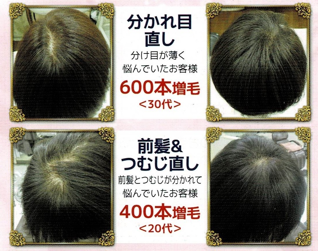 3Dビフォーアフター3