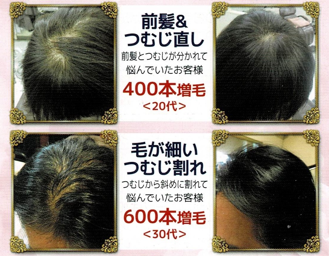 3Dビフォーアフター4