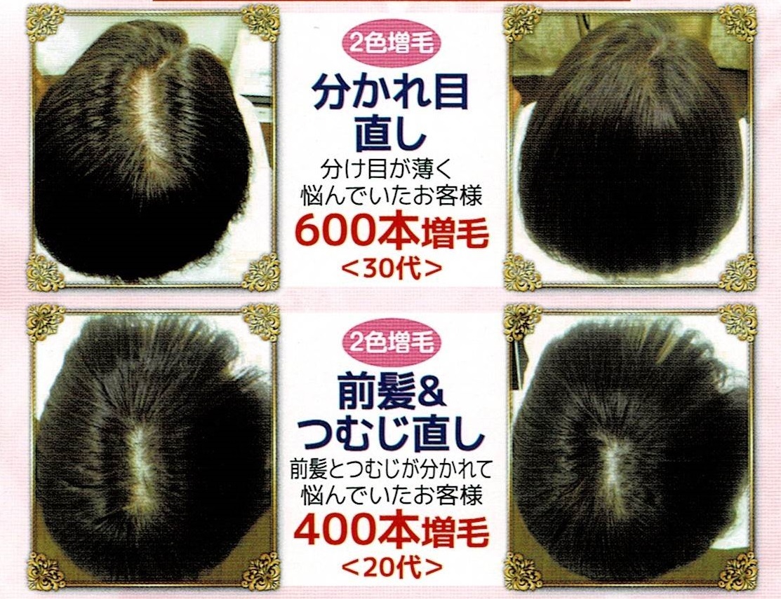 3Dビフォーアフター5