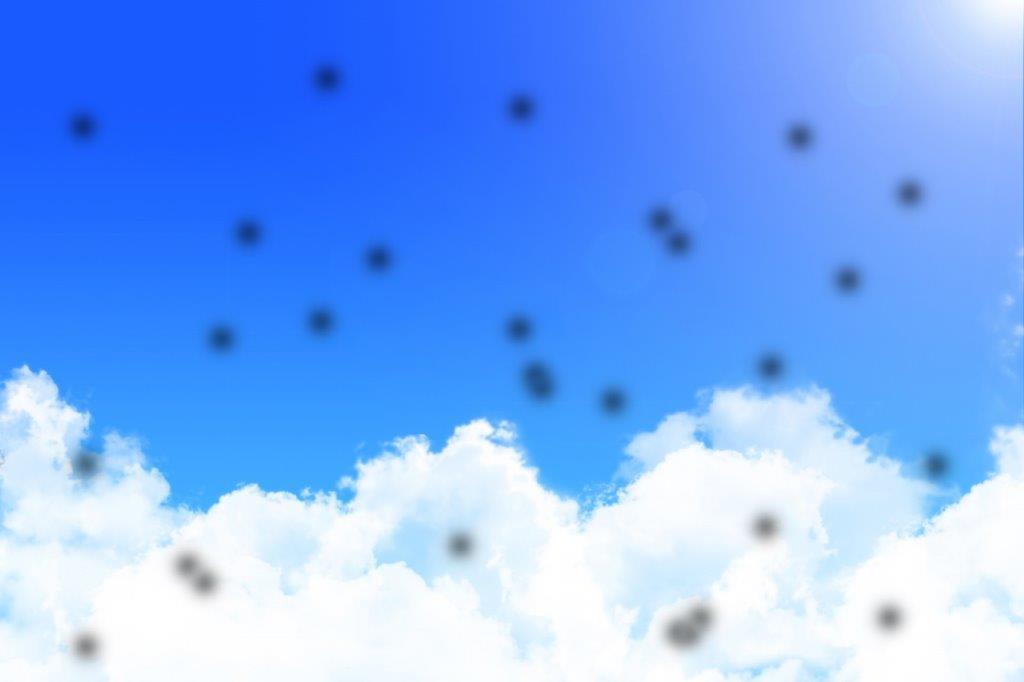 5.黒いものが見える (飛蚊症)